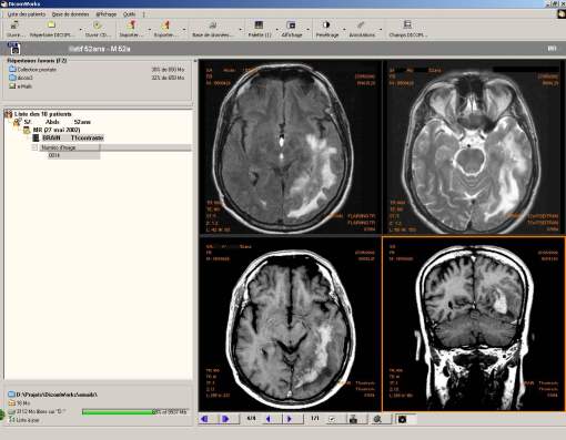 DICOM Viewer application