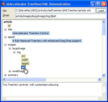 XML TreeView Sample